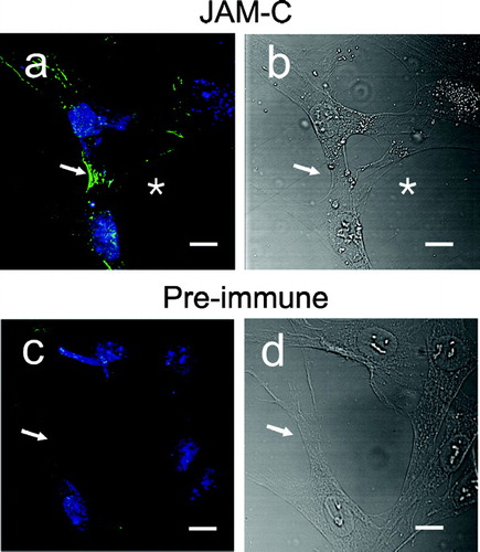 Figure 6 Immunofluorescence of JAM-C in adherent human dermal fibroblast cultures. Fibroblasts were fixed, blocked, and then stained for JAM-C or control (preimmune) using rabbit polyclonal antibodies followed by goat anti-rabbit Alexa-488. Nuclei were stained with TOTO-3 and RNase treatment was used to reduce cytoplasmic staining. Nuclei are blue in all panels. A, JAM-C staining (green); (→) JAM-C concentrated at cell–cell contacts; (*) JAM-C absent from exploratory filipodia. B, corresponding DIC image of panel a. C, preimmune antibody staining (green). (→), lack of preimmune staining at cell–cell contacts. D, corresponding DIC image of panel c. (→), cell–cell contacts. Images were analyzed using Zeiss LSM Image Examiner™ software. All panels were collected and displayed utilizing identical signal detection/gain settings. Scale bars, 10 μm.