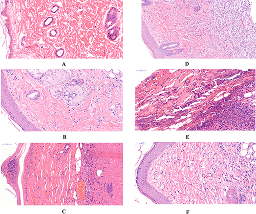 Figure 6 Histomorphology of rat skin in each group (HE staining, 40×).