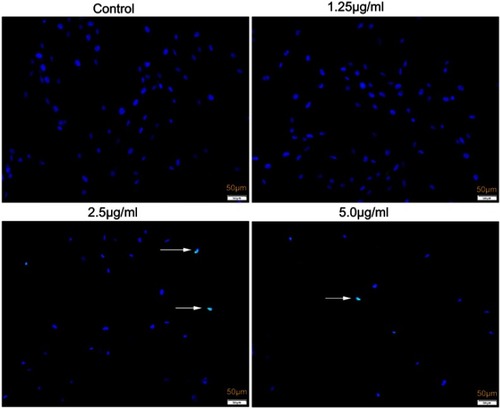 Figure 8 TUNEL assay of apoptosis of HSFs treated with different concentrations of cuprous oxide nanoparticles (CONPs) for 24 h. 2.5 μg/mL and 5.0 µg/mL CONPs caused significant TUNEL positive cells in HSFs.