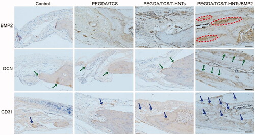 Figure 9. The immunohistochemical BMP-2, OCN and CD31 examinations of the osteogenic potential of the hydrogels were performed at 3 month for control, PEGDA/TCS, PEGDA/TCS/T-HNTs and PEGDA/TCS/T-HNTs/BMP-2 groups, respectively. The scale bar is 100 μm. The red ovals represent BMP2 proteins, green arrows represent OCN proteins, blue arrows represent CD31 proteins.