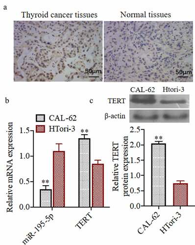 Figure 1. Expression of miR-195-5p and TERT in thyroid cancer cells and normal cells. (a)The TERT expression was evaluated by Immunohistochemistry, (200×). (b) The miR-195-5p and TERT mRNA expression was evaluated by qRT-PCR.(c) The TERT protein expression was evaluated by western blot. **P < 0.01 vs. CAL-62 group. Each experiment was repeated three times