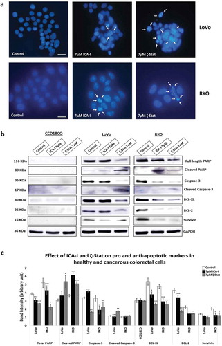 Figure 9. Atypical PKC inhibitors induce apoptosis in CRC cells. Cells were treated for 72 hours with 7 μM of either ICA-I or ζ-Stat. Following treatment, (a) Cellular nuclei were visualized using DAPI. Original magnification 20X and scale bars represent 10 μm. The white arrows are showing the cells undergoing apoptosis. (b) An equal amount of protein (40 μg) from cellular extracts of both normal and CRC cells were separated by SDS-PAGE, followed by Western blot analysis with different pro and anti-apoptotic antibodies. GAPDH was used as a loading control. (c) The bar charts represent the corresponding band intensities of apoptotic and survival markers. N = 3, Mean ± S.E.M. * represents p value where * < 0.05, ** < 0.02 and *** < 0.01.