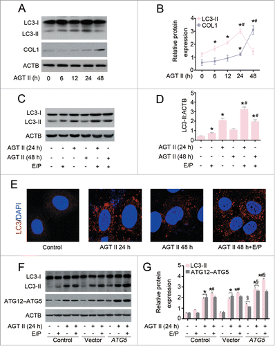 Figure 6. Overexpression of ATG5 augments AGT II-mediated autophagy in vitro. (A) Serum-deprived HK-2 cells were treated with 10−6 mol/L of AGT II for the indicated time period. Cell lysates were probed with antibodies against LC3 and COL1. ACTB was used as a loading control. (B) Densitometry of LC3-II and COL1 proteins in immunoblots (relative to ACTB). Data are means ± SEM (n = 3); *, P <0.001 vs. control group. #, P <0.001 vs. AGT II-treated cells for 12 or 24 h. (C) Cells were treated with AGT II at 10−6 mol/L for 24 and 48 h in the presence or absence of E64d and pepstatin A (E/P). Induction of autophagy was assessed by analyzing the expression of LC3. ACTB was used as a loading control. (D) Densitometry of LC3-II in immunoblots (relative to ACTB). Data are means ± SEM (n = 3); *, P < 0.001 vs. control group; #, P < 0.05 vs. AGT II-treated cells at the same time point in the absence of E/P. (E) Cells were treated with AGT II (10−6 mol/L) for 24 and 48 h in the absence or presence of E/P. Formation of LC3 puncta was analyzed by immunofluorescence under confocal microscopy (×400). (F) Cells were transfected with either pcDNA3.1-ATG5 or pcDNA3.1-HA vector followed by incubation with 10−6 mol/L of AGT II for 24 h. LC3 and ATG12–ATG5 conjugation protein levels were examined by Western blotting. ACTB was used as a loading control. (G) LC3 and ATG5 contents were quantitatively analyzed using a densitometer. Values are mean ± SEM (n = 3); *, P < 0.001 vs. control group in the same condition; #, P < 0.05 vs. AGT II-treated cells in the corresponding condition without E/P; §, P < 0.05 vs. cells transfected with empty vector in the corresponding condition.