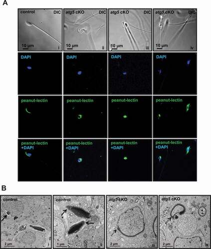 Figure 5. Abnormal acrosome biogenesis in the atg5 cKO mice. (A) Immunofluorescence staining was performed on cauda epididymal sperm from control (left panel) and atg5 cKO mice (right three panels). Peanut-lectin was used as a marker for acrosome. The images show the abnormal acrosome formation in the atg5 cKO mice. (B) Examination of spermatid acrosome in the testis seminiferous tubules of control (i, ii) and atg5 cKO mice (iii, iv) by electronic microscopy. In the control mouse, normal acrosome development can be seen in the round and elongating spermatids (arrows in i and ii). However, in the atg5 cKO mice, abnormal acrosome development was present (dashed arrows in iii and iv)