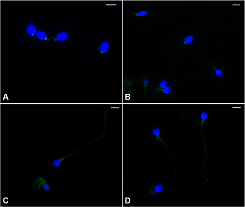 Figure 2 UV micrographs of human sperm of fertile (A and B) and infertile men with varicocele and infection (C and D) treated with an antibody anti- omentin-1/ITLN1. In sperm of fertile men (A and B), the labelling is evident in a spot located in the connecting piece and in the midpiece. In sperm of patients with varicocele (C) and infection (D) the entire tail is labelled. The nuclei are stained with DAPI. Bars: 6 μm.