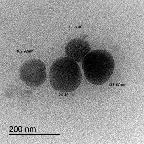 Figure 3 Transmission electron microscope (TEM) of optimized flibanserin nanostructured lipid carriers (FLB-NLCs) with 30,000X magnification.