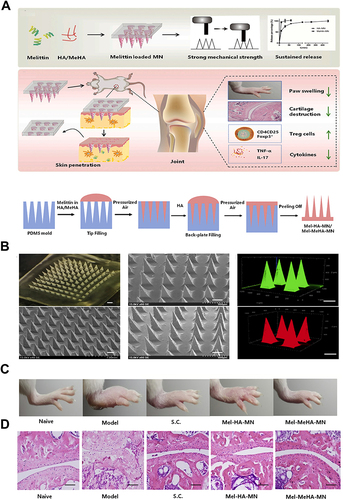 Figure 8 (A) Scheme of microneedle-mediated delivery of melittin for RA treatment. (B) Scheme of the micro-molding method for fabrication of microneedles. (C) Morphological characterization of MNs. (D) Representative images of paws from different groups. And H&E staining of mice paws. Scale bar: 400 μm. Reprinted from J Control Release, 336, Du G, He P, Zhao J, et al. Polymeric microneedle-mediated transdermal delivery of melittin for rheumatoid arthritis treatment. 537–548, copyright 2021, with permission from Elsevier.Citation18