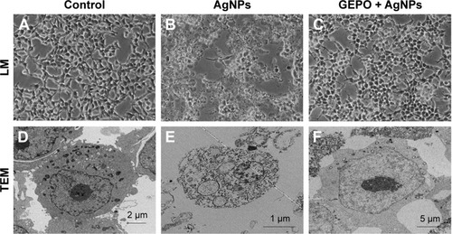 Figure 3 Effect of AgNPs and GEPO on cell morphology.Notes: Light microscopy and TEM images of untreated cells showed no morphological changes (A and D). After 4 hours of exposure to AgNPs, morphological structures indicating cellular damage and apoptosis were detected (B and E). Pretreatment with GEPO maintained a near normal cell shape (C and F). (A–C) 200× magnification used.Abbreviations: AgNPs, silver nanoparticles; GEPO, glutaraldehyde erythropoietin; TEM, transmission electron microscopy; LM, light microscopy.