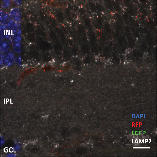 Figure 9. Representative high magnification image of the inner retina shows phagosome occurrence in the inner retinal cell types. Cytosolic EGFP signal was diminished in the inner retina, with far fewer immature phagosomes. Immunohistochemistry against LAMP2 shows that the majority of the phagosomes were mature autolysosomes. Scale bar: 10 µm.