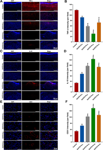 Figure 7 In vivo effects of Gel/CS-AuNPs on inflammatory response and neovascularization of diabetic wounds. (A) Immunofluorescence images the expression of the pro-inflammatory cytokine TNF-α. Scar bars:200 μm. (B) Mean fluorescence density per field of view for TNF-α. (C) Immunofluorescence images the expression of anti-inflammatory cytokine IL-10. Scar bars: 200 μm. (D) Mean fluorescence density per field of view for IL-10. (E) Immunofluorescence images the expression of CD31. Scale bars: 20 μm. (F) Mean fluorescence density per field of view for CD31. Histograms were plotted with the mean ± standard deviation values (n = 3) (*Denotes P < 0.05 compared with the control group; #Denotes P < 0.05 compared with the Gel/CS-Au5 group; ΔDenotes P < 0.05 compared with the Gel/CS-Au10 group; ◇Denotes P < 0.05 compared with the Gel/CS-Au25 group).