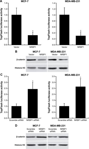 Figure 5 NRBP1 regulates transcriptional activity of Wnt/β-catenin signaling pathway in breast cancer.