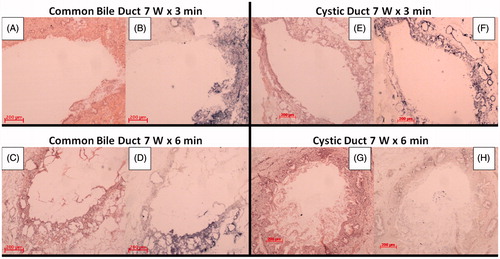 Figure 5. Histological samples of common bile duct after H&E (A) and NADH (B) staining at 3 min, and H&E (C) and NADH (D) staining at 6 min. Histological samples of the cystic duct after H&E (E) and NADH (F) staining at 3 min, and H&E (G) and NADH (H) staining at 6 min (Zeiss Axiophot, 5x enlargement). In B, D, and E the dark (blue) zones correspond to the vital tissue left after the ablation.