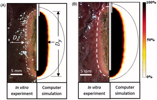 Figure 6. Computational and experimental results for two ablation operations: (A) 360 s, (B) 720 s.