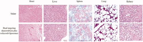 Figure 11. Preliminary toxicity comparison on the major organs of the intracranial glioma-bearing nude mice after treatment with dual targeting daunorubicin plus rofecoxib liposomes.