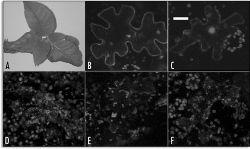 Figure 9 Agroinfiltration of N. tabacum leaves with GFP-SP1, GFP-H3M and GFP. (A) 48 hours after transient transformation with GFP-H3M, leaf tissue was unable to maintain turgor; (B) epidermal cell accumulating GFP-SP1 on the PM and in some internal areas; (C) when cytosolic GFP is accumulated, fluorescence appears uniformly distributed in cytosol and nucleus; (D) epidermal cell accumulating GFP-H3M in the ER (the nuclear membrane is labelled) and associated to small compartments; (E) GFP-H3M distributed in the cell's periphery probably associated to the PM (no ER labelling is clearly visible); (F) GFP-H3M accumulated in small endosomes-like spherical bodies with a non-fluorescent lumen; all fluorescent images are confocal projection of 6–8 m, scale bar = 20 µ.