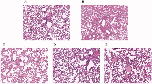 Figure 8. Effect of Qiangli Wuhu mixture on lung tissue injury in mice with LPS-induced pneumonia. (A) Control group; (B) vehicle group; (C) low dose Qiangli Wuhu mixture (10 g/kg) group; (D) high dose Qiangli Wuhu mixture (20 g/kg) group; (E) DXM (10 mg/kg) group.