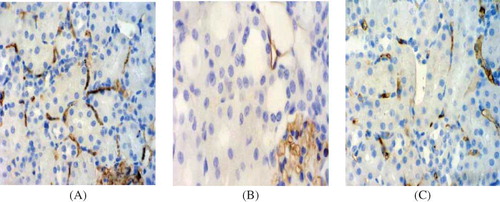 Figure 3. PTC staining in tissue samples. (×400). (A) Control group at day 7. The PTC of control group kidneys displayed uniform size and shape, and were regularly arranged in most of the interstitium. (B) Model group at day 7. The staining of PTC was obviously decreased. (C) PGE1 group at day 7. The positive staining was slightly decreased.