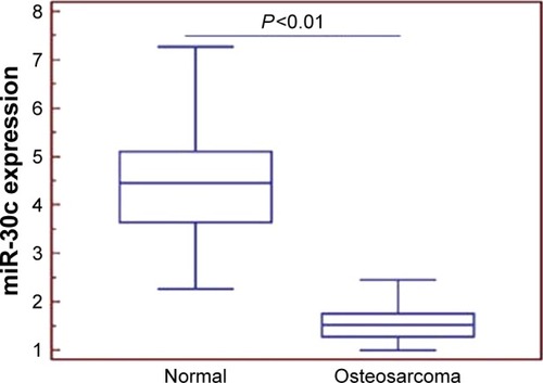 Figure 1 It was shown by qRT-PCR tests of miR-30c that its expression was significantly different between the normal and osteosarcoma cells (4.62±1.12 vs 1.37±0.42, P<0.01).