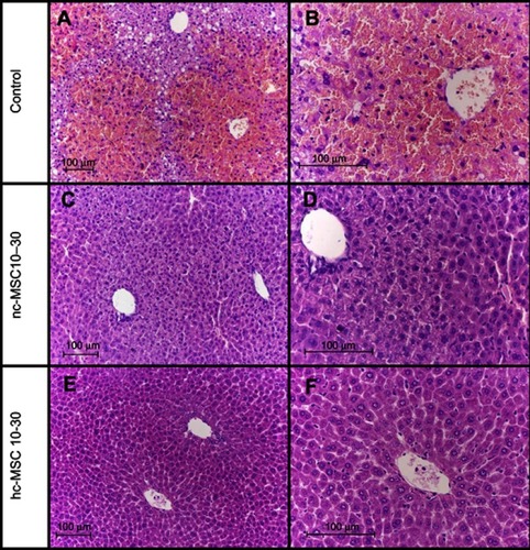 Figure 3 Histology of mouse liver after acetaminophen injection (270 mg/kg), stained with hematoxylin and eosin. Control 4 hrs after the injection (A) x160; (B) x400; 4 hrs after acetaminophen injection (270 mg/kg) and simultaneous treatment with ncMSC (10–30 kDa) protein compositions (C) x200; (D) x400; 4 hrs after acetaminophen injection (270 mg/kg) and simultaneous treatment with hcMSC (10–30 kDa) protein compositions (E) x200; (F) x400.Abbreviations: hc-MSC, MSCs cultured under hypoxic (10% O2 hc-MSC) condition; nc-MSC MSCs cultured under normal (21% O2 nc-MSC) condition.
