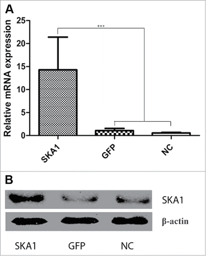 Figure 4. Analysis of SKA1 expression in osteosarcoma SOSP-9607 cells infected with LV-SKA1-GFP, LV-GFP and NC cells. (A) mRNA expression of SKA1 in human osteosarcoma SOSP-9607 cells infected with LV-SKA1-GFP, LV-GFP and NC cells, as measured by qRT-PCR. (B) SKA1 protein expression as measured by western blot. Both qRT-PCR and western blot analyses results were normalized with β-actin. *P < 0.05, **P < 0.01, ***P < 0.001.