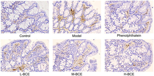Figure 4. BCE reduced the expression of AQP3 in colon. Protein expression of AQP3 in the colon was identified by immunohistochemical analysis, ×400. n = 10 per group.