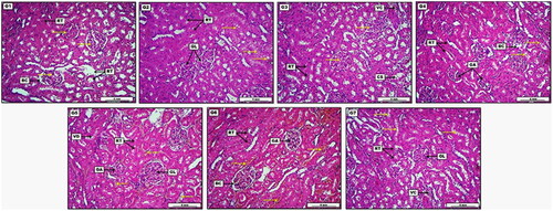 Figure 7. Photomicrograph of kidney from groups; G1: Control negative group received (D.W); G2: Low dose group (G2) treated with 30 mg/kg of S-AgNPs-CSCFX; G3: Medium dose group (G3), treated 60 mg/kg of S-AgNPs-CSCFX; G4: High dose group (G4) treated with 90 mg/kg of S-AgNPs-CSCFX; G5: Low dose group (G5), treated with 30 mg/kg of blank S-AgNPs; G6: Medium dose group (G6), treated with 60 mg/kg of blank S-AgNPs; G7: high dose group (G7), treated with 90 mg/kg of blank S-AgNPs; H&E. Scale bar: 4 mm.