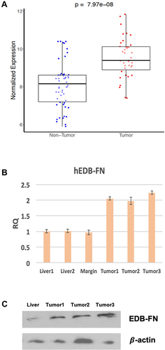 Figure 2 Validation results indicating highly expressed EDB-FN in the woodchuck HCC. (A) Higher EDB-FN expression in the woodchuck HCC compared to the surrounding hepatic tissues analyzed from the customized microarray data; Higher EDB-FN expression in HCC compared to the surrounding liver determined in harvested tissue samples from the woodchucks carrying HCC with RT-PCR (B) and Western blotting (C).