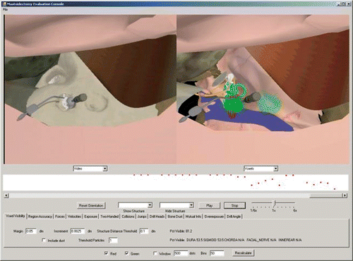 Figure 4. An overview of the console, with the visibility metric selected. It is clear that the user used proper saucerizing technique while making the hole on the right but is now undercutting while drilling the hole on the left. Red dots in the visually annotated reconstructed model view show where the mistake occurred, and the metric-versus-time graph below the display panels shows when it occurred. [Color version available online.]