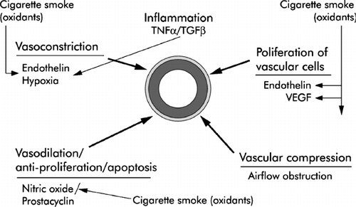 Figure 11 Mechanisms of endothelial dysfunction and vascular remodeling in the small pulmonary arteries of patients with COPD. Source: (Citation[185]), Fig. 2, p. 607. Diagram showing various cigarette smoke-related processes that drive vasoconstriction, vasodilation, and cell proliferation in the walls of the small pulmonary arteries. Most of the effects shown are potentially directly mediated by oxidants in the smoke acting on the vessel wall. The vessel is shown in the centre with muscular layer and adventitial layers highlighted. Oxidants in the smoke cause production of the vasoconstrictor endothelin and the vasoproliferative agents endothelin and vascular endothelial growth factor (VEGF). Smoke interferes with nitric oxide mediated vasodilation by decreasing nitric oxide bioactivity. Air trapping as part of chronic airflow obstruction appears to play an early role by inducing vascular compression, and hypoxia causes vasoconstriction, but only when the oxygen tension is extremely low.