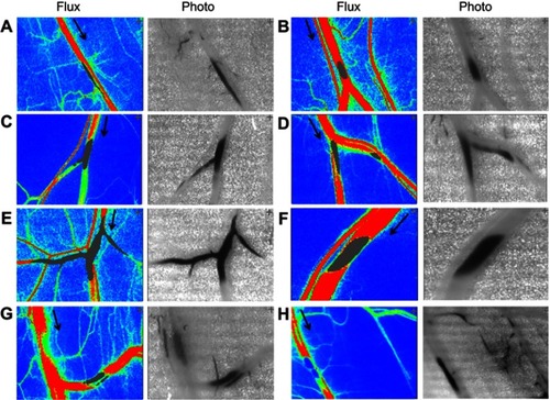 Figure S2 Magnetic capture of MNP and subsequent flow changes in microvessels. MNPs (5 mg/kg) were administered intra-arterially to the left cremaster muscle with a NdFeB magnet placed underneath. MNP accumulation 1 to 14 mins after administration is illustrated as flux and photo images. The arrow in the flux images indicates the flow direction of the adjacent vessel. Patterns of magnetic capture of MNPs in microvessels (A–H) were observed.