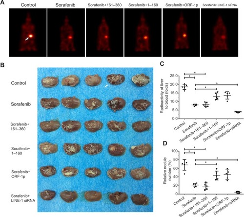 Figure 10 LINE-1 ORF-1p decreased the antitumor effect of sorafenib in inhibiting MHCC97-H cell intrahepatic growth in vivo.Notes: (A) MHCC97-H cells, which were transfected with an empty vector, a full length LINE-1 ORF-1p vector, LINE-1 ORF-1p 1–160 residues, control siRNA or LINE-1 ORF-1p siRNA vectors were seeded into nude mouse livers via the hepatic portal vein to form intrahepatic tumors. The mice received sorafenib and were screened using PET/CT. (B) The results are shown as representative photographs of livers with nodules formed by MHCC97-H cells, (C) the radioactivation of liver to blood or (D) the relative nodule area. *P<0.05.Abbreviation: PET/CT, positron emission tomography/computed tomography.