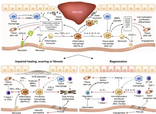 Figure 7 Multiple immunologic reactions during tissue repair and regeneration process.Notes: Biomaterials-based tissue-engineered scaffolds are developed to deliver molecules, which promote regenerative pathways rather than proinflammatory pathways. Reprinted from Acta Biomater, 53, Julier Z, Park AJ, Briquez PS, Martino MM, Promoting tissue regeneration by modulating the immune system, 13–28, Copyright (2017), with permission from Elsevier.Citation197Abbreviations: ECM, extracellular matrix; IFN, interferon; IGF, insulin-like growth factor; MMP, matrix metalloproteinase; PDGF, platelet-derived growth factor; TIMP, tissue inhibitor of metalloproteinase; TNF, tumor necrosis factor; VEGF, vascular endothelial growth factor.