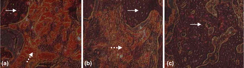 Figure 7. Histological Slice of Control Group (→denote bony callus, [FX] denote gelatin). a. 2 weeks later, lots of gelatin can be seen between the broken ends; b. 8 weeks later, few gelatin degraded, not many bony calluses forming; and c. 12 weeks later, a little residual gelatin remained, much bony callus forming.