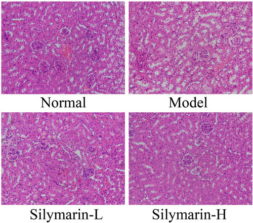 Figure 4 H&E pathological staining structure of kidney tissues. Model: treated with D-Gal/LPS (30 mg/kg·bw/3 μg/kg·bw) intraperitoneal injection; silymarin-L: treated with silymarin (75 mg/kg·bw) intragastric administration; silymarin-H: treated with silymarin (150 mg/kg·bw) intragastric administration.