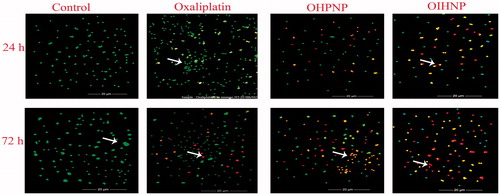 Figure 4. Fluorescent microscopic images of HT-29 colon cancer lines with immunonanoparticles, OHNPs, and pure drug (oxaliplatin) at 24 h and 72 h. Control was visualized by green fluorescence at all time intervals conforming its viability. Oxaliplatin had shown minimal fluorescence of light orange and green representing minimal apoptosis. OIHNPs had shown appreciable apoptosis attributing to the major part of the cells with red fluorescence.