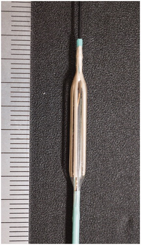 Figure 1. A prototype balloon-radiofrequency ablation catheter was used in this study. The catheter has a 3.5-mm diameter balloon at the tip and 8 stretchable electronic inks are printed along the balloon’s length.