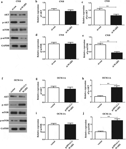 Figure 6. Detection of the effect of WARS on AKT/mTOR pathway in UM cells by western blotting assay. (a-e) Downregulation of WARS suppresses the AKT/mTOR pathway in UM C918 cells. (f-j) Upregulation of WARS promotes the AKT/mTOR pathway in UM OCM-1A cells.