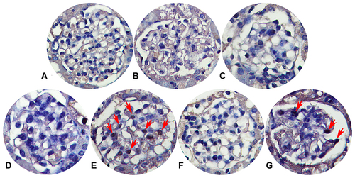 Figure 8 Glomerular apoptosis detection (×400). (A) Blank control group. (B) Solvent control group. (C) TCE+BQ123 control group. (D) TCE sensitized negative group. (E) TCE sensitized positive group. (F) TCE+BQ123 sensitized negative group. (G) TCE+BQ123 sensitized positive group. Red arrow: apoptotic cells.