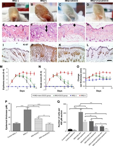 Figure 4 Effect of topically applied free EGCG and nanoEGCG on IMQ-induced psoriasis-like ear/skin lesions. (A–L) Mouse ears and back skins were shaved, then topically treated with either control cream (IMQ(−)) (A, E, I) or IMQ alone (IMQ(+)) (B, F, J) for 14 days. Two additional IMQ+ groups were co-treated with either free EGCG (C, G, K) or nanoEGCG (D, H, L) starting at day 5 for 9 additional days (depicted in treatment protocol diagram, Figure S5). Photomicrographs show: (A–D) ears with IMQ-induced erythema and scaling; (E–H) H&E-stained histological sections of skin showing pathological features (arrows in panels F, G, and H represent the thickness of the back skin epidermis in the respective groups); (I–L) Ki67-stained sections of skin showing (hyper)proliferation. For panels E–L, magnification ×200. Scale bar=50 µM. Arrows represent the thickness of the back skin epidermis in the respective groups. (M–Q) Quantitative assessments of changes reflecting the following pathological hallmarks of psoriasis: (M) inflamed ear erythema, (N) degree of scaling, (O) changes in ear thickness over time, (P) epidermal thickness at the end of the experiment, and (Q) proportion of Ki67+-cells in total skin and epidermis. For (M–Q), each data point represents the mean of 6 random fields per mouse per treatment group with 5 mice/group. *p<0.05, **p<0.01, ***p<0.001, and ****p<0.0001.Abbreviations: EGCG, (−)-epigallocatechin-3-gallate; nanoEGCG, chitosan-based polymeric nanoparticle formulation of EGCG; IMQ, imiquimod.