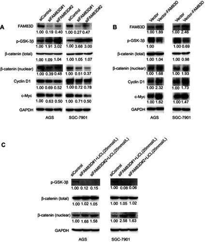 Figure 9 FAM83D activates Wnt/β-catenin signaling. Western blotting analysis of expression of p-GSK-3β, β-catenin, cyclin D1 and c-Myc in AGS and SGC-7901 cells after FAM83D depletion. (B) Western blotting analysis after FAM83D overexpression. (C) Western blotting analysis between siControl+LiCL (20mmol/L), siFAM83D#1+LiCL(20mmol/L) and siFAM83D#2+LiCL (20mmol/L) in AGS or SGC-7901 cell line.