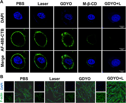 Figure 4 Membrane lipid rafts and F-actin of cancer cells. (A) AF488-CTB-tagged membrane lipid rafts and DAPI-stained nucleus were visible to CLSM, scale bar = 20 μm. (B) SCC9 cells show an increased F-actin polymerization as shown in the fluorescence images. Scale = 15 μm.