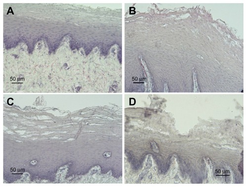 Figure 3 Representative examples of cross-sections of esophageal mucosa (H&E) treated with saline (A) or different damaging solutions (B–D). (A) No damage (grade 0). (B) Acid solution (60 minutes): mild damage (grade 1) extended throughout one or two epithelial layers. (C) Pepsin solution (30 minutes); moderate damage (grade 2) mainly localized on superficial layers. A disorganization of epithelial layers was observed along the tissue, with some intact areas and areas in which erosion interested from 30% to 50% of mucosal thickness. (D) Acid solution (90 minutes); severe damage (grade 3) and complete erosion of keratinic epithelial layers, with injury extending through more than 50% of epithelial stratified layer.