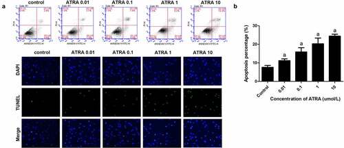 Figure 2. ATRA enhances apoptotic cell death of rEHBMCs. (a) and (b) rEHBMCs were treated with ATRA for 24 h at 0.01, 0.1, 1 and 10 µmol/L. Percentages of apoptotic cells were quantified by flow cytometry. (c) Apoptosis was evaluated by TUNEL staining assay. Data are shown as means ± SD of at least three independent experiments. aP < 0.05 vs control group