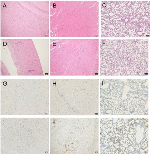 Figure 5. Histopathological analysis of brain, muscle, and lung tissues of mice after challenge with EV-A71 via intracerebral injection (magnification ×100). Three euthanized mice were used to examine the pathological changes in part of the tissues. (a–c) Hematoxylin and eosin staining showed no obvious histopathological changes in the brain (a), muscles, (b) and lungs (c) of mice immunized with the EV-A71 vaccine. (d–f) Hematoxylin and eosin showed minimal perivascular inflammatory infiltrates in the brain (d), minimal mixed cell infiltration in the muscle interstitium (e) and no obvious histopathological changes in the lungs (f) of unimmunized mice. (g–i) Immunohistochemistry (IHC) in tissue of immunized mice after challenged with EV-A71 via the I.C. route, with negative staining of the brain (g), muscle, (h) and lung (i) tissues. (j–l) Immunohistochemistry (IHC) in tissues of unimmunized mice after challenge with EV-A71 via the I.C. route, with positive staining of the brain (j), muscle (k), and lung (l) tissues.