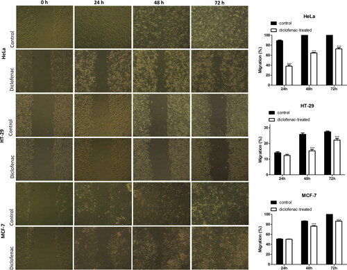 Figure 2. Fluorescence microscopy of acridine orange/ethidium bromid stained human tumour cells after 24-h treatment with diclofenac. HeLa cells (a, b): control (a) and treated (b) with 300 µg/mL diclofenac; HT-29 cells (c, d): control (c) and treated (d) with 100 µg/mL diclofenac; MCF-7 cells (e, f): control (e) and treated (f) with 300 µg/mL diclofenac. 40Х magnification.