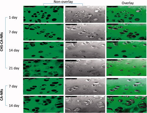 Figure 4. Confocal laser microscopy photos for articular cartilage received CHS-CA-NRs and CA-NRs, showing strong fluorescent signals in the cytoplasm of chondrocytes with CHA-CA-NRs injection over 21 days while little fluorescent signals were observed inside chondrocytes with CA-NRs injection over 14 days, magnification × 63.