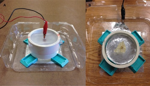 Figure 3 (A) Ablation experiment setup; (B) post-ablation colon tissue.