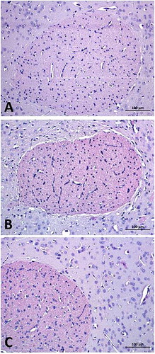 Figure 9. Sections of brain tissues of Saline (A), Sham (B) and US (C) groups respectively. Nucleus accumbens around anterior commissure are seen. Hematoxylin–Eosine, ×20 lens.