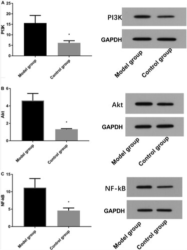 Figure 5. Comparison of protein expression between model and control groups by Western blot. A: Western blot method for column and protein figures for PI3 K expression (ab140307,1:1000) level. B: Western blot method for column and protein figures for Akt (ab38449,1:1000) expression level. C: Western blot method for column and protein figures for NF-kB (ab32536,1:1000) expression level.