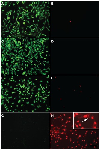 Figure 4 Cell viability after hyperthermia treatments. 1321N1 cells were stained with calcein and propidium iodide to visualize live (green) and dead (red) cells, respectively. (A and B) Control cells stained with calcein and propidium iodide, respectively. (C and D) 1321N1 cells irradiated with laser at 1.2 W for 20 minutes and subsequently stained with (C) calcein and (D) propidium iodide. (E and F) 1321N1 cells incubated with 36 μg/mL gold nanorods for 20 minutes and stained for (E) calcein and (F) propidium iodide. (G and H) 1321N1 cells incubated with 36 μg/mL gold nanorods and subjected to laser irradiation at 1.2 W for 20 minutes and then stained for calcein (G) and propidium iodide (H).Notes: Inset in (H) shows an area of the same field at a higher magnification. Scale bar 50 μm.